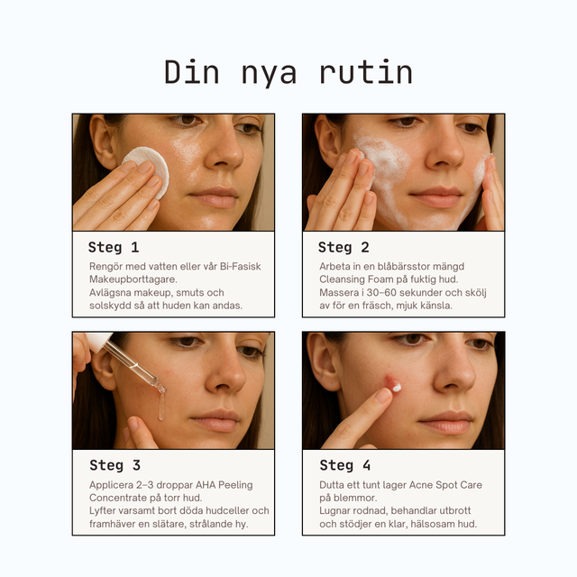 Acne Care Collection – Klar Hud Box